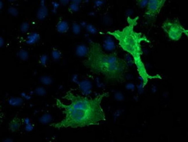 LNK Antibody in Immunocytochemistry (ICC/IF)