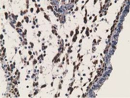 RBP1 Antibody in Immunohistochemistry (Paraffin) (IHC (P))