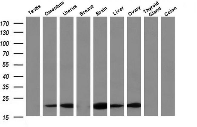 RBP1 Antibody in Western Blot (WB)