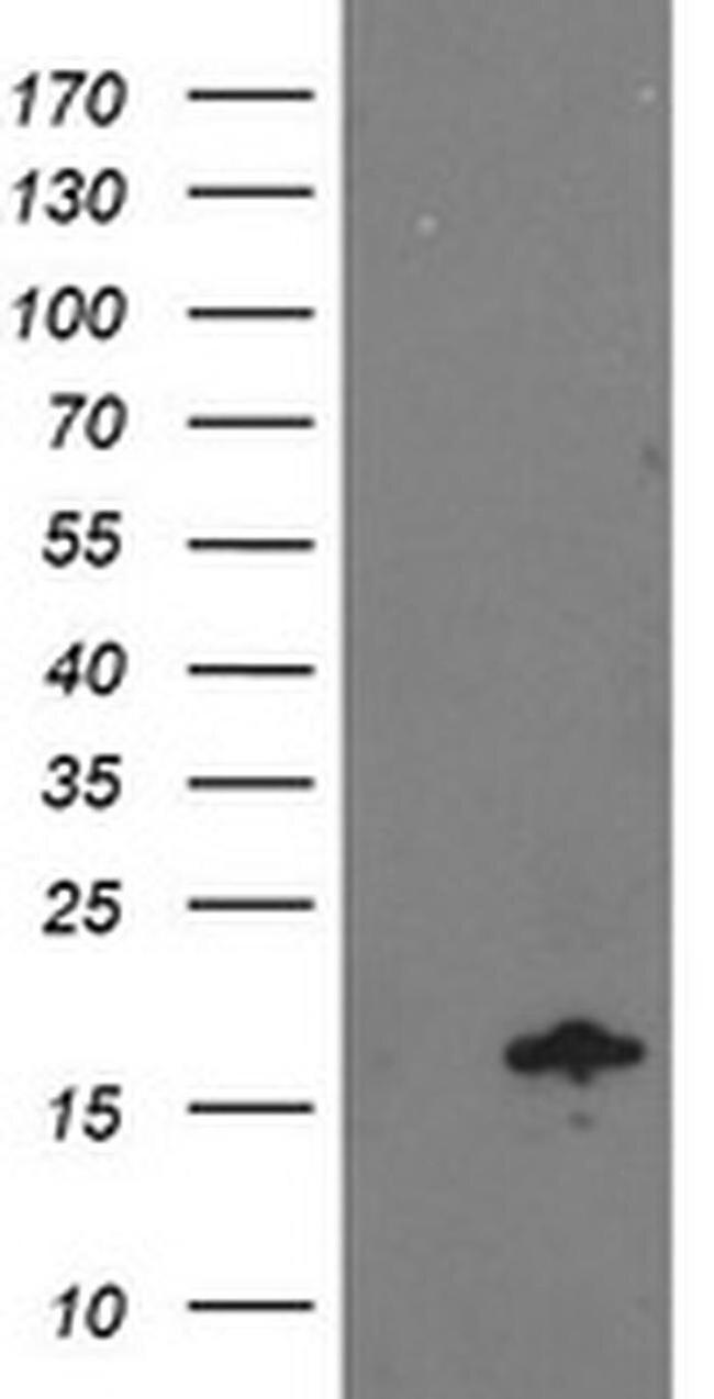 NDUFA7 Antibody in Western Blot (WB)