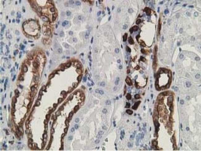 LNK Antibody in Immunohistochemistry (Paraffin) (IHC (P))