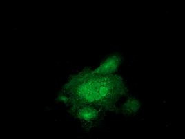 MAPRE2 Antibody in Immunocytochemistry (ICC/IF)