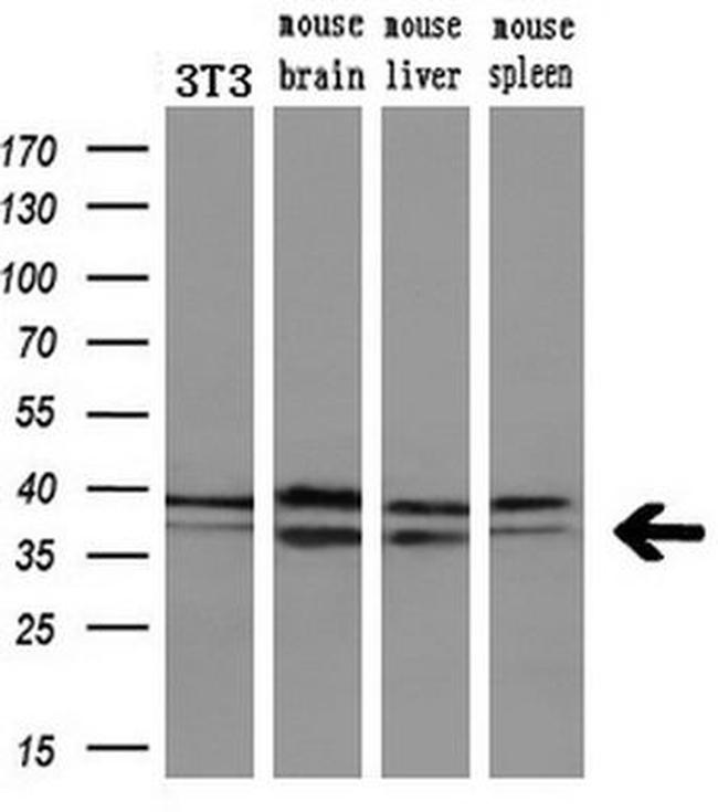 MAPRE2 Antibody in Western Blot (WB)