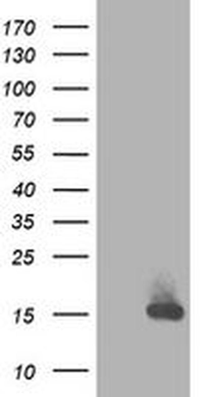 RBP1 Antibody in Western Blot (WB)