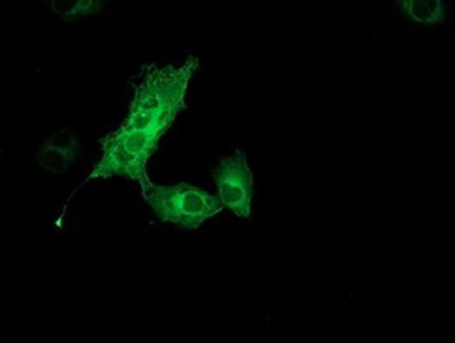 Monoacylglycerol Lipase Antibody in Immunocytochemistry (ICC/IF)