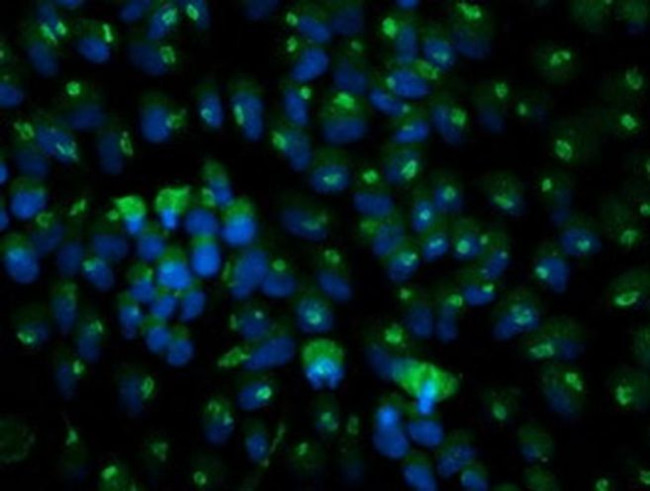 Monoacylglycerol Lipase Antibody in Immunocytochemistry (ICC/IF)