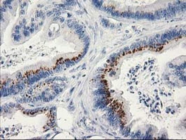 Monoacylglycerol Lipase Antibody in Immunohistochemistry (Paraffin) (IHC (P))