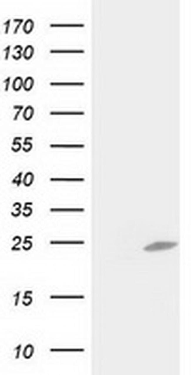 C1orf50 Antibody in Western Blot (WB)