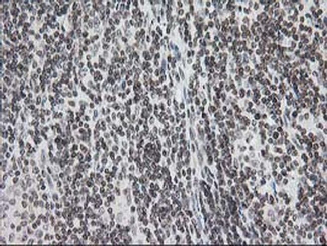 CRY2 Antibody in Immunohistochemistry (Paraffin) (IHC (P))