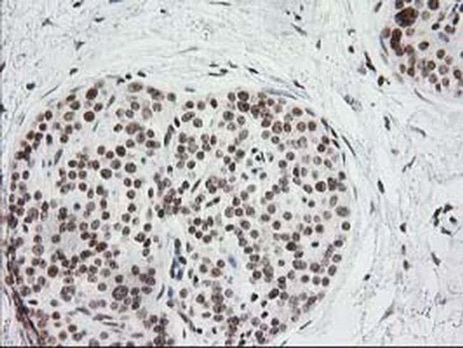 CRY2 Antibody in Immunohistochemistry (Paraffin) (IHC (P))