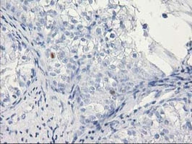 C1orf50 Antibody in Immunohistochemistry (Paraffin) (IHC (P))