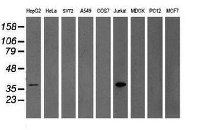 GRAP2 Antibody in Western Blot (WB)