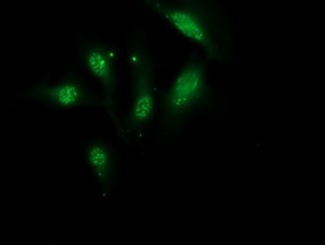 Monoacylglycerol Lipase Antibody in Immunocytochemistry (ICC/IF)