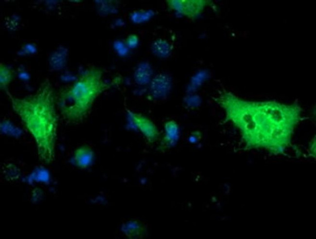 Monoacylglycerol Lipase Antibody in Immunocytochemistry (ICC/IF)