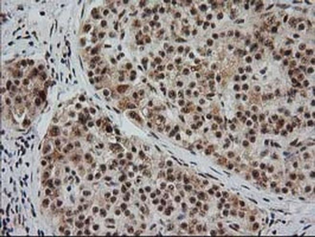 Monoacylglycerol Lipase Antibody in Immunohistochemistry (Paraffin) (IHC (P))