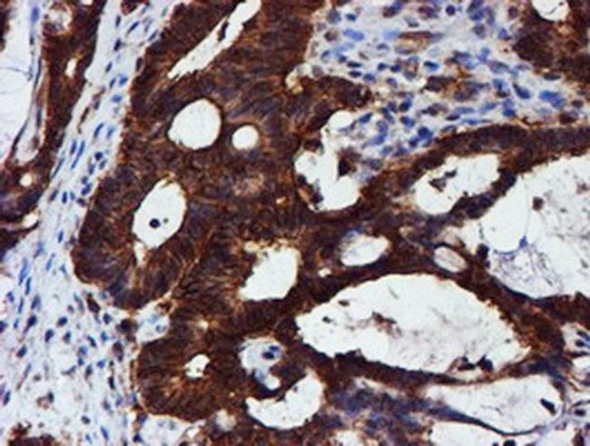 C1orf50 Antibody in Immunohistochemistry (Paraffin) (IHC (P))