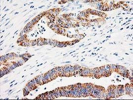 Adenylate Kinase 4 Antibody in Immunohistochemistry (Paraffin) (IHC (P))