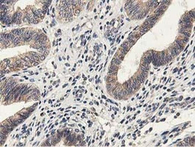 LGR5 Antibody in Immunohistochemistry (Paraffin) (IHC (P))