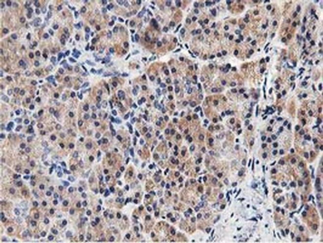 LGR5 Antibody in Immunohistochemistry (Paraffin) (IHC (P))