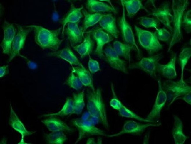 beta-4 Tubulin Antibody in Immunocytochemistry (ICC/IF)