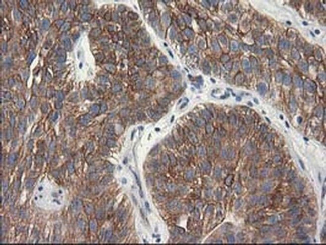 beta-4 Tubulin Antibody in Immunohistochemistry (Paraffin) (IHC (P))