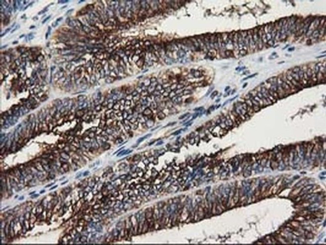 beta-4 Tubulin Antibody in Immunohistochemistry (Paraffin) (IHC (P))