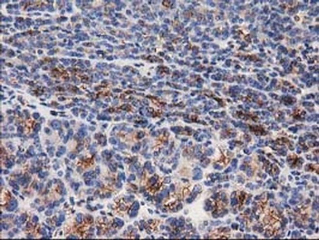 beta-4 Tubulin Antibody in Immunohistochemistry (Paraffin) (IHC (P))