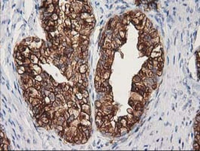 beta-4 Tubulin Antibody in Immunohistochemistry (Paraffin) (IHC (P))