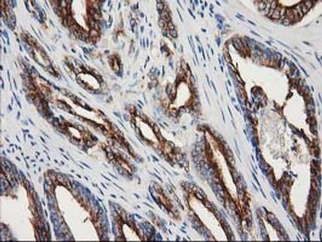 beta-4 Tubulin Antibody in Immunohistochemistry (Paraffin) (IHC (P))