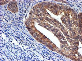 NDUFAF7 Antibody in Immunohistochemistry (Paraffin) (IHC (P))