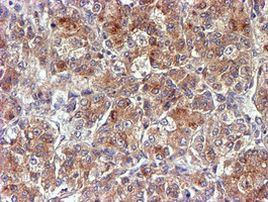 NDUFAF7 Antibody in Immunohistochemistry (Paraffin) (IHC (P))