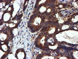 NDUFAF7 Antibody in Immunohistochemistry (Paraffin) (IHC (P))