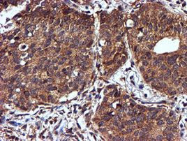 NDUFAF7 Antibody in Immunohistochemistry (Paraffin) (IHC (P))