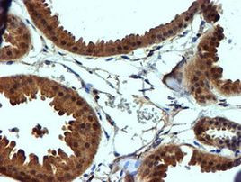 NDUFAF7 Antibody in Immunohistochemistry (Paraffin) (IHC (P))