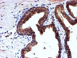 NDUFAF7 Antibody in Immunohistochemistry (Paraffin) (IHC (P))