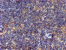 NDUFAF7 Antibody in Immunohistochemistry (Paraffin) (IHC (P))