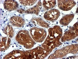 NDUFAF7 Antibody in Immunohistochemistry (Paraffin) (IHC (P))