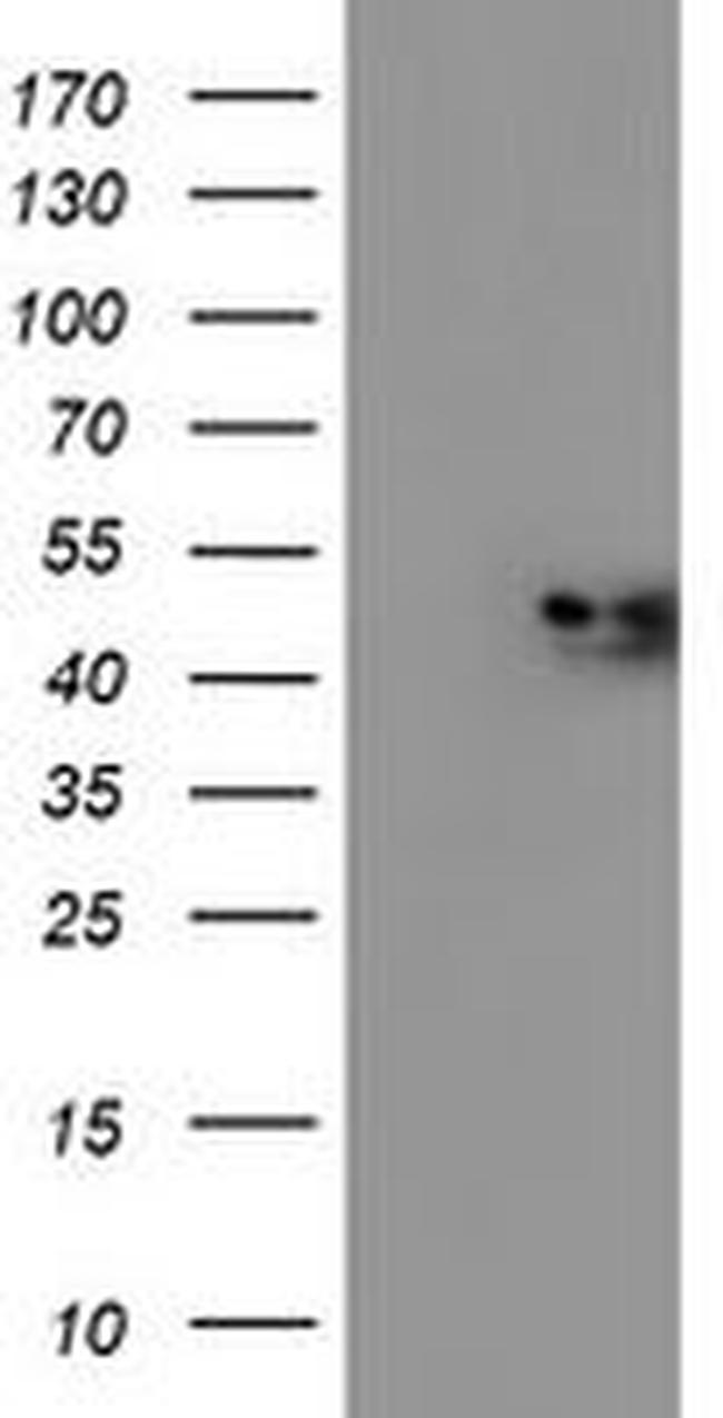 NDUFAF7 Antibody in Western Blot (WB)