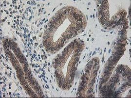 PDXK Antibody in Immunohistochemistry (Paraffin) (IHC (P))