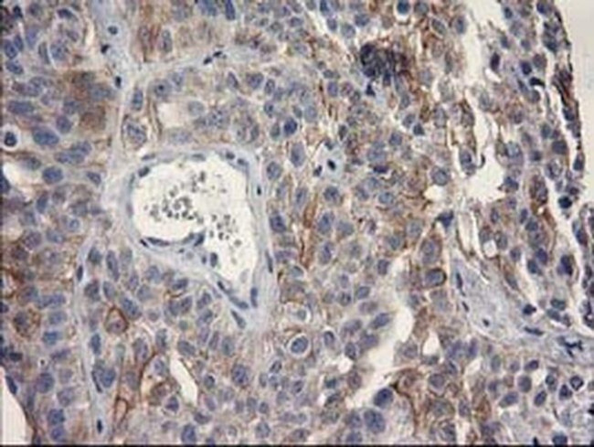 OSGEP Antibody in Immunohistochemistry (Paraffin) (IHC (P))