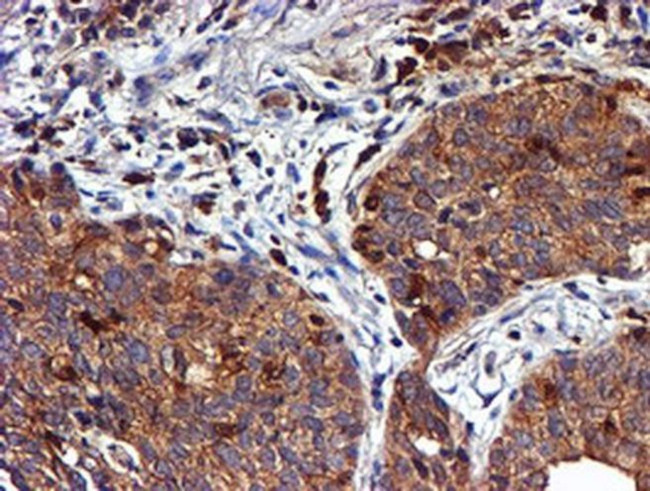 LIMK1 Antibody in Immunohistochemistry (Paraffin) (IHC (P))