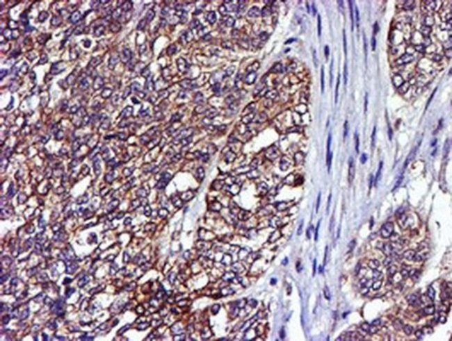 LIMK1 Antibody in Immunohistochemistry (Paraffin) (IHC (P))