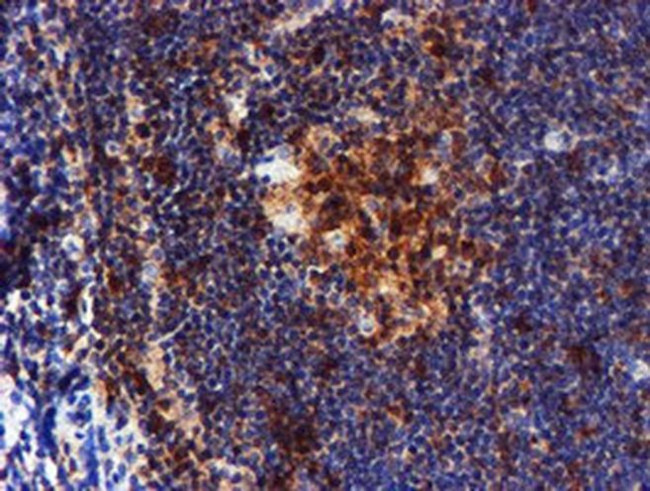 LIMK1 Antibody in Immunohistochemistry (Paraffin) (IHC (P))