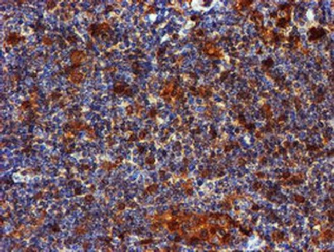 LIMK1 Antibody in Immunohistochemistry (Paraffin) (IHC (P))