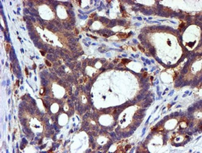 LIMK1 Antibody in Immunohistochemistry (Paraffin) (IHC (P))