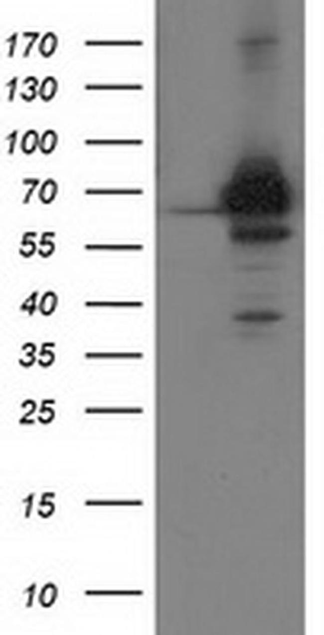 CoA Synthase Antibody in Western Blot (WB)