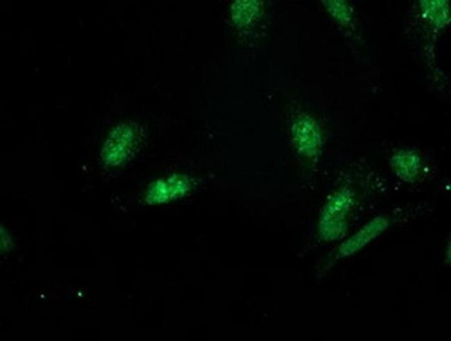 GSPT2 Antibody in Immunocytochemistry (ICC/IF)