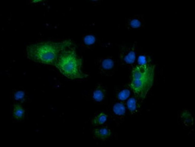 GSPT2 Antibody in Immunocytochemistry (ICC/IF)