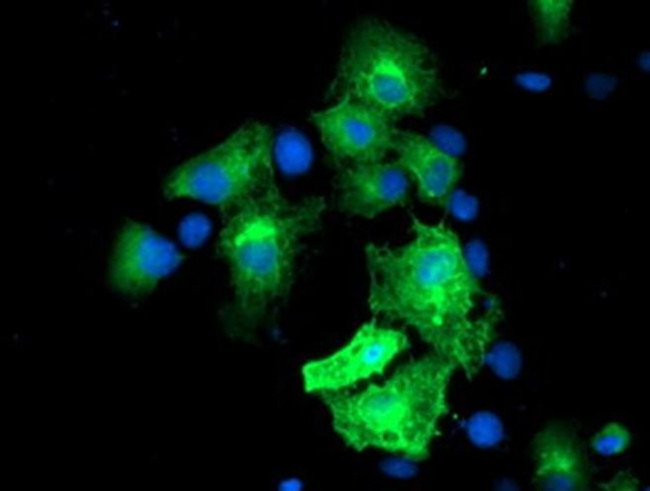 Monoacylglycerol Lipase Antibody in Immunocytochemistry (ICC/IF)