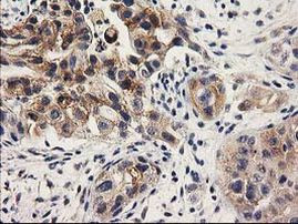 ILVBL Antibody in Immunohistochemistry (Paraffin) (IHC (P))